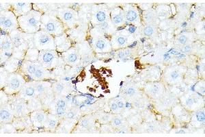 Immunohistochemistry of paraffin-embedded Mouse liver using SPTA1 Polyclonal Antibody at dilution of 1:100 (40x lens). (SPTA1 抗体)