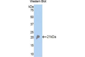 Western blot analysis of the recombinant protein. (CFP 抗体  (AA 310-459))