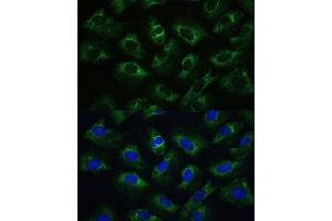 Immunofluorescence (IF) image for anti-Poly(A) Binding Protein, Cytoplasmic 1 (PABPC1) (AA 350-450) antibody (ABIN7269446)