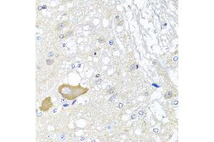 Immunohistochemistry of paraffin-embedded rat brain using MCCC2 antibody at dilution of 1:100 (x40 lens). (MCCC2 抗体)