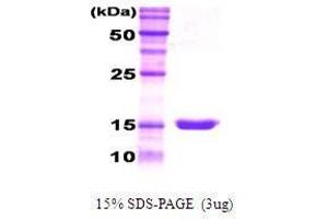 Figure annotation denotes ug of protein loaded and % gel used. (G-CSF 蛋白)