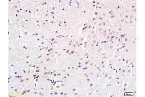Immunohistochemistry (IHC) image for anti-Zinc Finger, MYND-Type Containing 11 (ZMYND11) (AA 501-602) antibody (ABIN872692)