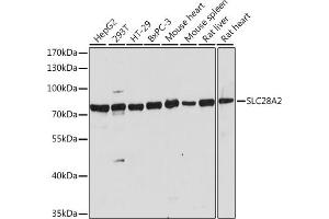 Western Blotting (WB) image for anti-Solute Carrier Family 28 (Sodium-Coupled Nucleoside Transporter), Member 2 (SLC28A2) (AA 350-450) antibody (ABIN7270447)