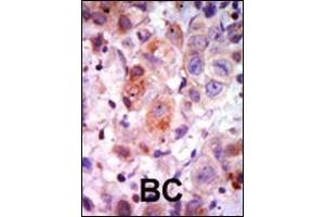 Immunohistochemistry (Paraffin-embedded Sections) (IHC (p)) image for anti-Adrenergic, Beta, Receptor Kinase 1 (ADRBK1) (AA 633-660), (C-Term) antibody (ABIN1882061)