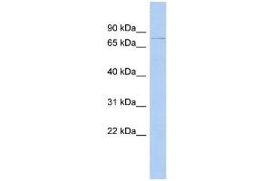 WB Suggested Anti-DHX58 Antibody Titration:  0. (DHX58 抗体  (N-Term))