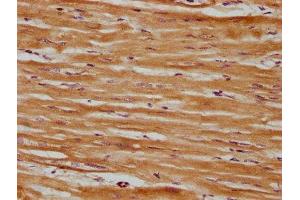 IHC image of ABIN7171044 diluted at 1:600 and staining in paraffin-embedded human heart tissue performed on a Leica BondTM system. (SRPX 抗体  (AA 31-237))