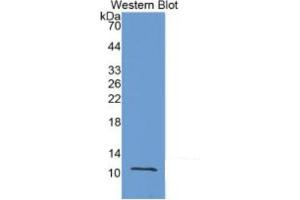 WB of Protein Standard: different control antibodies against Highly purified E. (MMP12 ELISA 试剂盒)