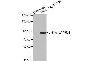 Western Blotting (WB) image for anti-Signal Transducer and Activator of Transcription 5A (STAT5A) (pTyr694) antibody (ABIN1870647) (STAT5A 抗体  (pTyr694))