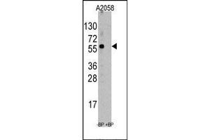 Image no. 1 for anti-Suppression of Tumorigenicity 13 (ST13) (N-Term) antibody (ABIN358737) (HSC70 Interacting Protein HIP 抗体  (N-Term))