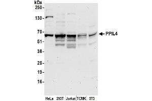 anti-Peptidylprolyl Isomerase (Cyclophilin)-Like 4 (PPIL4) (AA 325-375) antibody