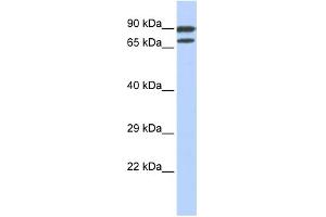 WB Suggested Anti-ZNF583 Antibody Titration:  0. (ZNF583 抗体  (N-Term))