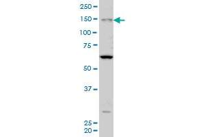 MYO3A monoclonal antibody (M08A), clone 8H2 Western Blot analysis of MYO3A expression in Hela S3 NE . (MYO3A 抗体  (AA 1400-1490))