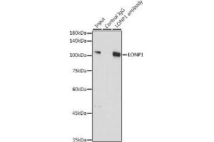 Immunoprecipitation analysis of 300 μg extracts of A-549 cells using 3 μg LONP1 antibody (ABIN1680707, ABIN3018785, ABIN3018786 and ABIN6220576). (LONP1 抗体  (AA 120-400))