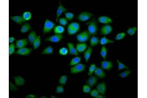 Immunofluorescence staining of Hela cells with ABIN7175695 at 1:66, counter-stained with DAPI. (WDFY2 抗体  (AA 2-114))