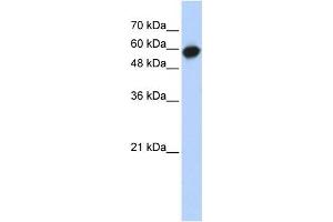 Western Blotting (WB) image for anti-Leucine Rich Repeat Containing 6 (LRRC6) antibody (ABIN2459700) (LRRC6 抗体)