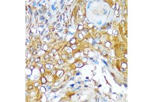 Immunohistochemistry (IHC) image for anti-Versican (Vcan) antibody (ABIN7271309)