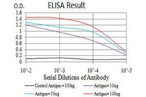 Black line: Control Antigen (100 ng),Purple line: Antigen (10 ng), Blue line: Antigen (50 ng), Red line:Antigen (100 ng) (UCP2 抗体  (AA 1-309))
