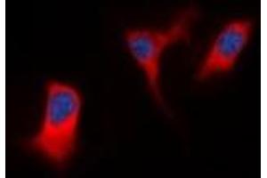 Immunofluorescent analysis of DAP Kinase 1 staining in K562 cells. (DAP Kinase 1 抗体)