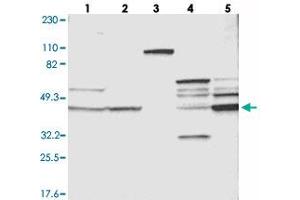 Western blot analysis of Lane 1: RT-4, Lane 2: U-251 MG, Lane 3: Human Plasma, Lane 4: Liver, Lane 5: Tonsil with VSIG4 polyclonal antibody . (VSIG4 抗体)