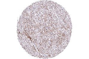 Cerebrum showing a moderate fibrillar GPM6A staining of nerve fibres (Recombinant GPM6A 抗体)