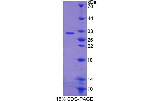 Image no. 1 for EGF Like Domain Protein, Multiple 7 (AA 24-273) protein (His tag) (ABIN6237635) (EGF Like Domain Protein, Multiple 7 (AA 24-273) protein (His tag))