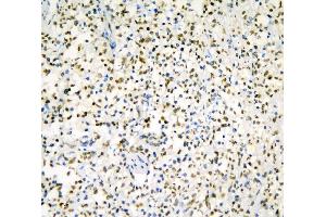 IHC analysis of HNRNPD using anti-HNRNPD antibody (ABIN7602590).