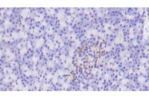 Detection of TLR5 in Human Pancreas Tissue using Polyclonal Antibody to Toll Like Receptor 5 (TLR5) (TLR5 抗体  (AA 303-514))