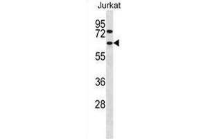 CCT4 Antibody (N-term) western blot analysis in Jurkat cell line lysates (35µg/lane). (CCT4 抗体  (N-Term))