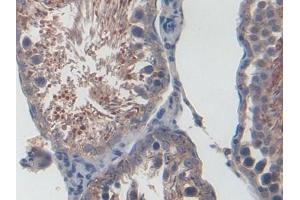 IHC-P analysis of Rat Testis Tissue, with DAB staining. (CXCL1 抗体  (AA 25-96))