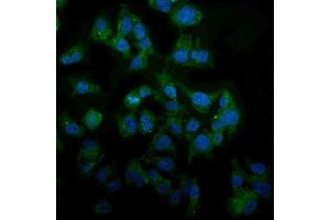IF analysis of MAP3K8 using anti-MAP3K8 antibody (ABIN4886663). (MAP3K8 抗体  (AA 9-193))