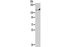 Gel: 6 % SDS-PAGE,Lysate: 40 μg,Primary antibody: ABIN7192352(SHANK1 Antibody) at dilution 1/200 dilution,Secondary antibody: Goat anti rabbit IgG at 1/8000 dilution,Exposure time: 1 minute (SHANK1 抗体)