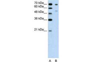 Western Blotting (WB) image for anti-Forkhead Box B2 (FOXB2) antibody (ABIN2462637) (FOXB2 抗体)