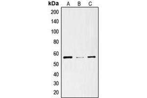 Western blot analysis of ENT1 expression in SKNSH (A), mouse heart (B), rat heart (C) whole cell lysates.