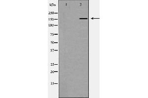 Western blot analysis of CUTL1 expression in K562 cells,The lane on the left is treated with the antigen-specific peptide. (CUX1 抗体  (N-Term))