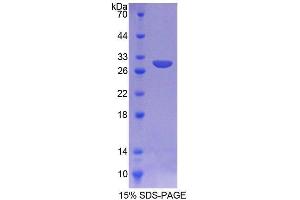 SDS-PAGE analysis of Mouse AGA Protein. (AGA 蛋白)