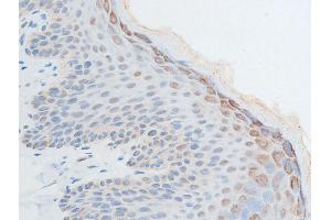 ABIN6267250 at 1/100 staining human skin tissue sections by IHC-P.