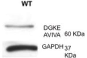 DGKE antibody - N-terminal region  validated by WB using lymph at 1:1000. (DGKE 抗体  (N-Term))
