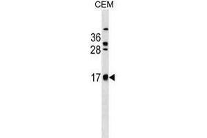 C Antibody (C-term) (ABIN1536654 and ABIN2849825) western blot analysis in CEM cell line lysates (35 μg/lane). (C2ORF83 抗体  (C-Term))
