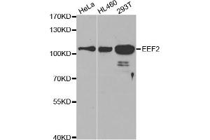Western blot analysis of extracts of various cell lines, using EEF2 antibody (ABIN5971099) at 1/500 dilution. (EEF2 抗体)
