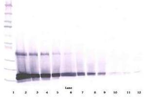 Image no. 5 for anti-KIT Ligand (KITLG) antibody (ABIN465573)