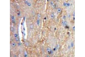 IHC-P analysis of Brain tissue, with DAB staining. (C1QA 抗体  (AA 23-245))