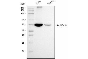Western blot analysis of ALDH1A1 using anti-ALDH1A1 antibody (ABIN7602128).