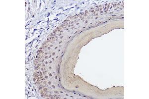 Immunohistochemistry of paraffin-embedded Mouse skin using SSC/SerpinB3 Rabbit mAb (ABIN7270242) at dilution of 1:100 (40x lens). (SERPINB3 抗体)