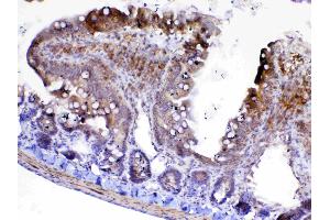 IHC analysis of Factor D using anti-Factor D antibody . (Adipsin 抗体  (AA 26-253))