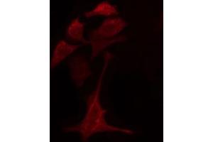 ABIN6274776 staining A549 cells by IF/ICC. (RPL28 抗体)