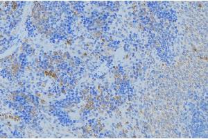 ABIN6277157 at 1/100 staining Human lymph node tissue by IHC-P. (KRT17 抗体  (C-Term))