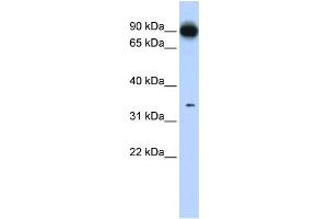 WB Suggested Anti-PRKRA Antibody Titration: 0. (PRKRA 抗体  (N-Term))
