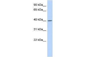 WB Suggested Anti-C11orf65 Antibody Titration: 0. (C11orf65 抗体  (N-Term))