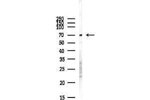 Western blot analysis of lysates from COLO205 cells(heat-shock,45 min treatment), using Smad4 Antibody at 1/1000 dilution.