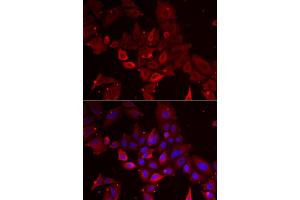Immunofluorescence analysis of U2OS cells using MYOT antibody (ABIN5973839). (Myotilin 抗体)